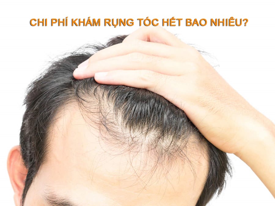 Những phương pháp điều trị rụng tóc phổ biến — chi phí, cơ chế và ai phù hợp?