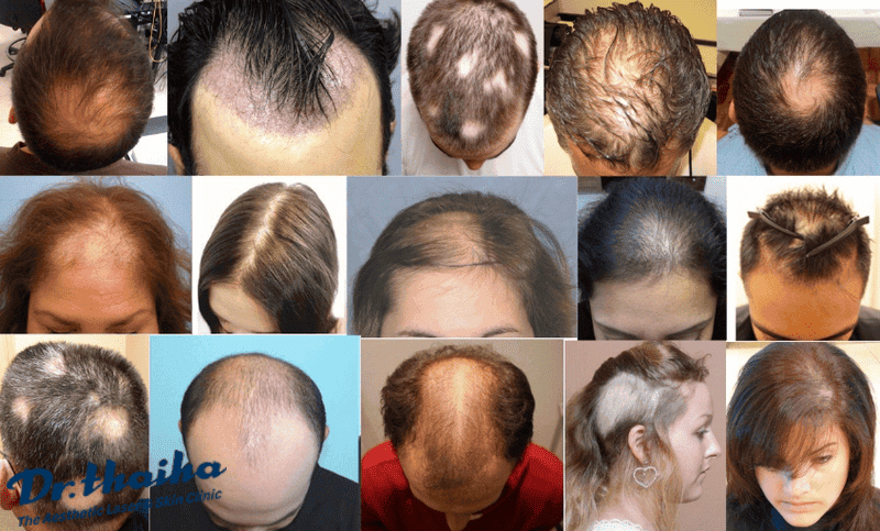 Bảng so sánh nhanh: lựa chọn tiết kiệm ngay vs đầu tư điều trị dài hạn?