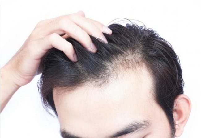 Rủi ro và chống chỉ định