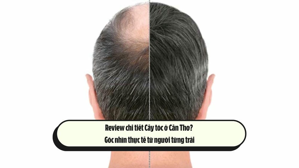 Chi phí và thời gian điều trị — nên cân nhắc những gì?