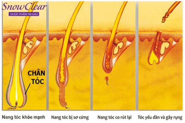 Các liệu pháp điều trị thường được đề xuất sau khi kiểm tra nang tóc — lựa chọn theo nguyên nhân