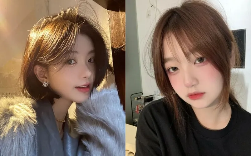 Lựa chọn giữa kiểu tóc, topping và can thiệp y khoa — so sánh nhanh để quyết định