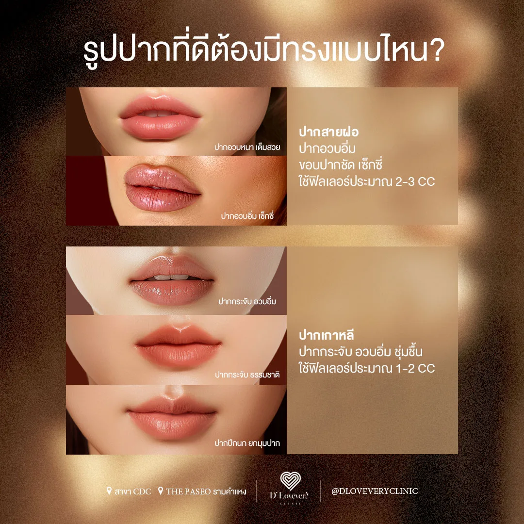 Chi phí tiêm filler môi phụ thuộc vào những yếu tố nào?
