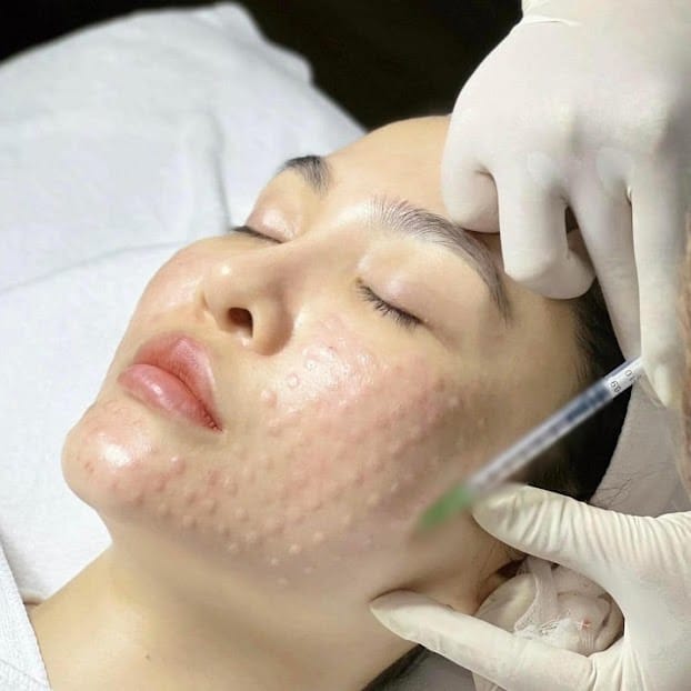 Cơ chế phân bố và chọn điểm BAP trên mặt