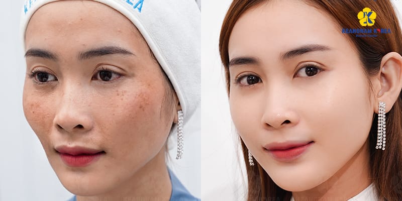 Lịch liệu trình và bảo trì