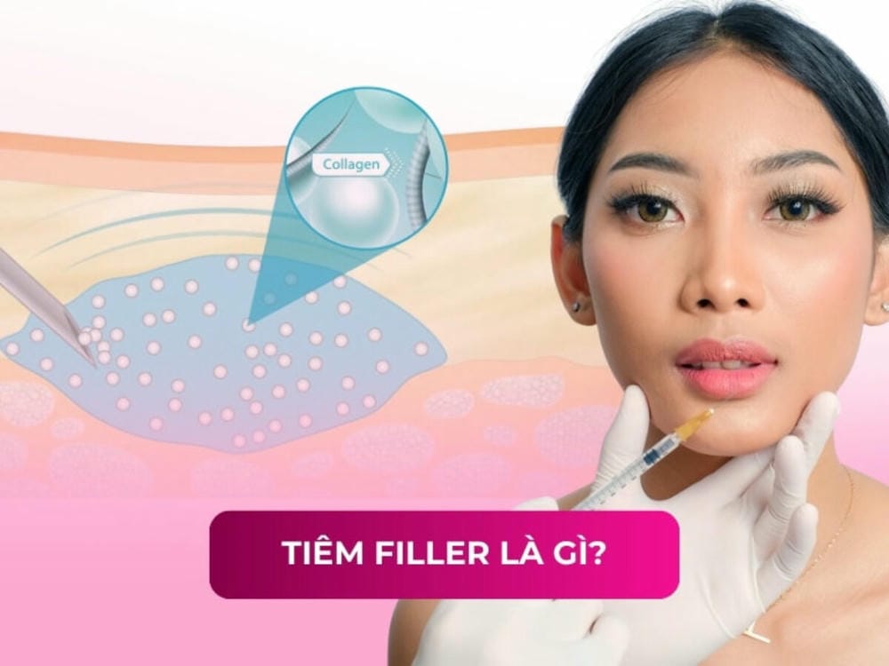Cannula hay kim — chọn như thế nào?