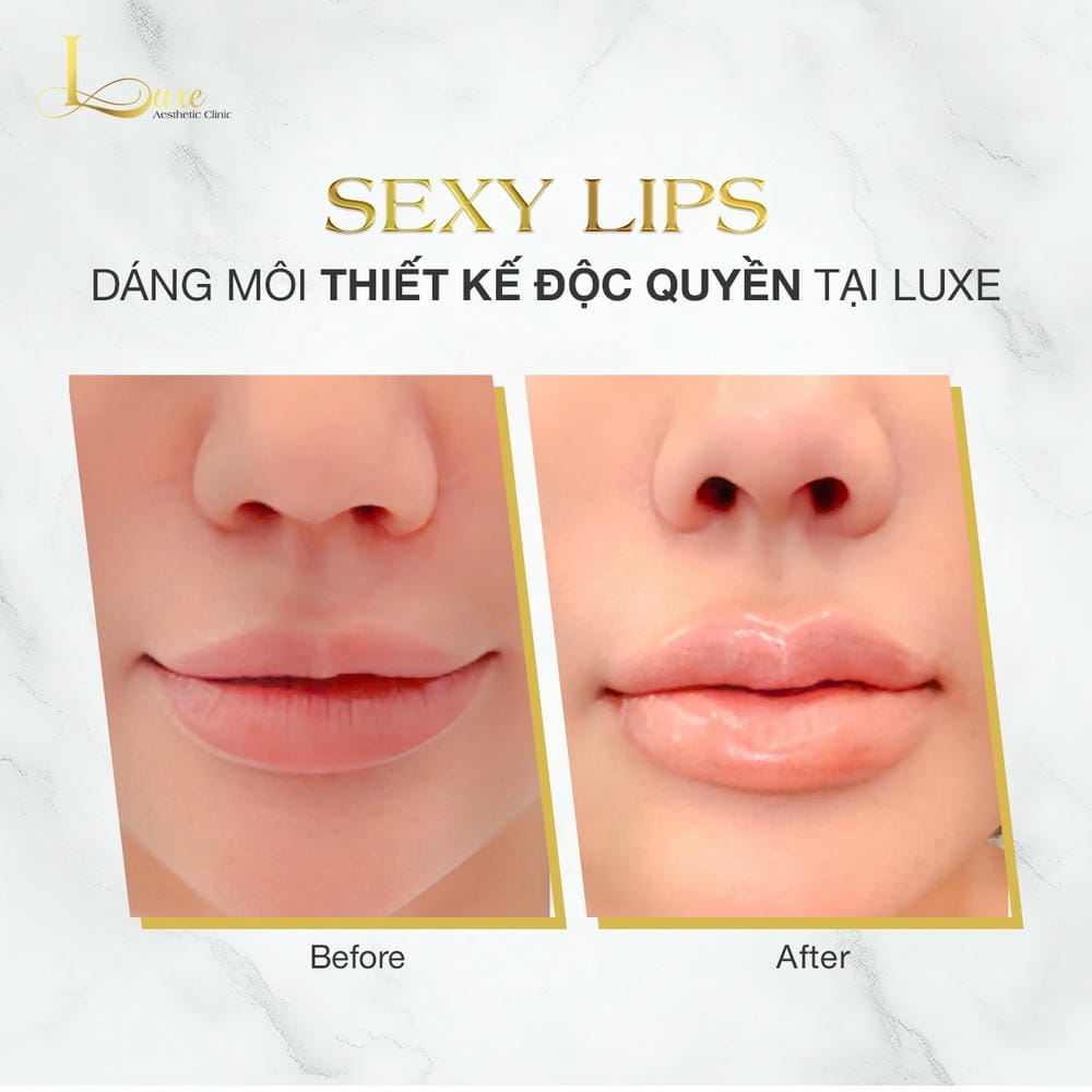 Làm sao để chọn bác sĩ và cơ sở tiêm filler an toàn — tiêu chí cụ thể?