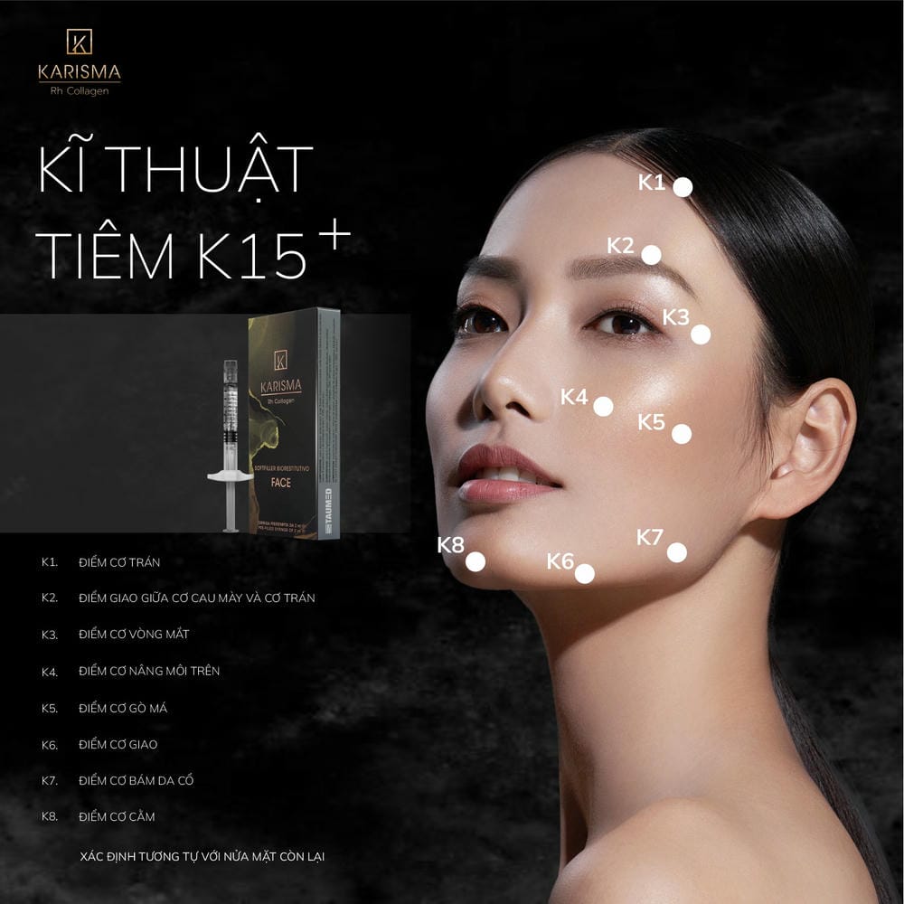 Liệu trình tiêm Karisma thường diễn ra như thế nào — bao nhiêu buổi và khoảng cách giữa các buổi?