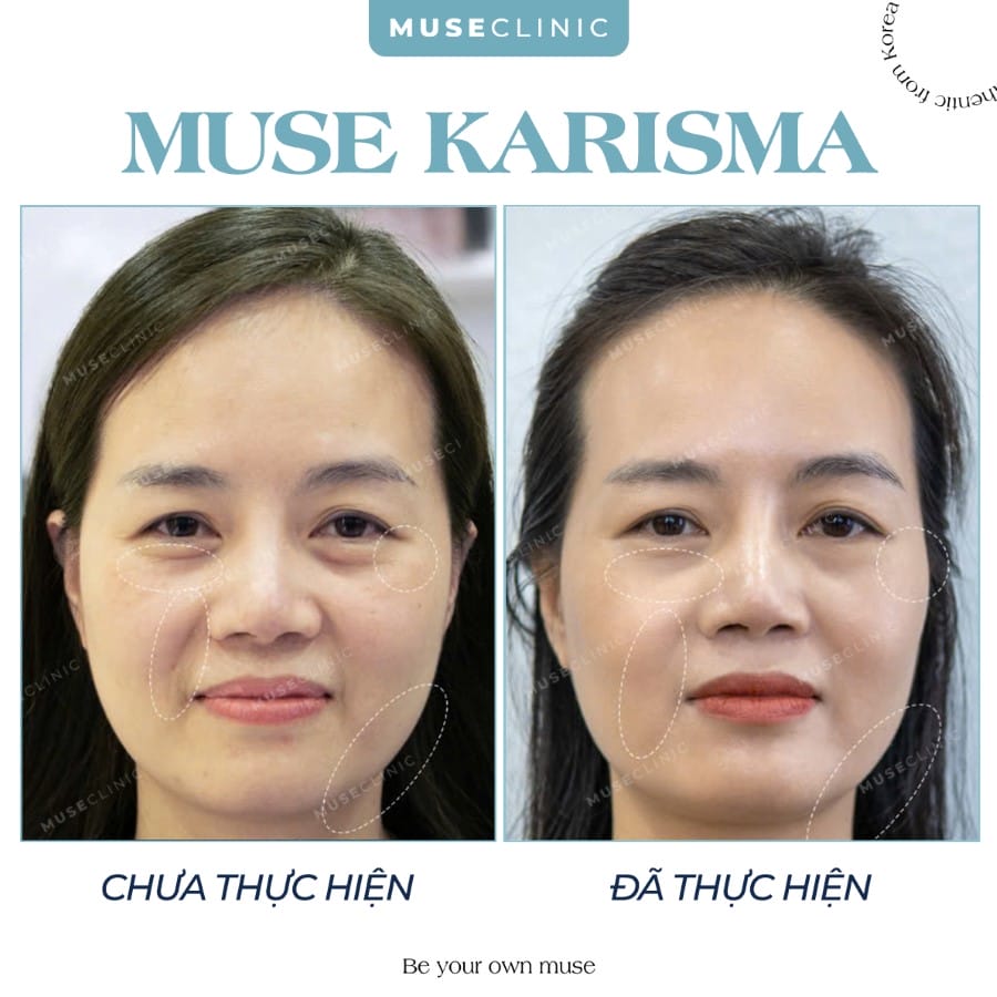 1. Kết quả thấy ngay không — và thấy rõ sau bao lâu?