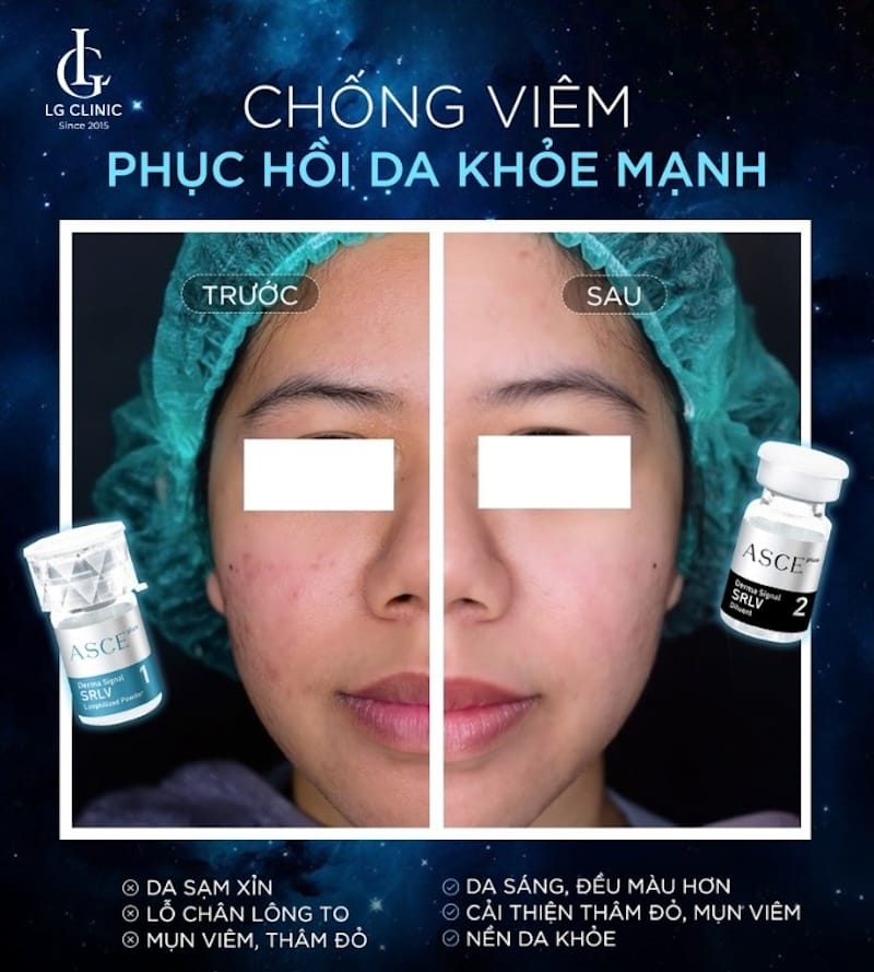 Sau khi tiêm cần chăm sóc như thế nào để đạt hiệu quả và tránh biến chứng?