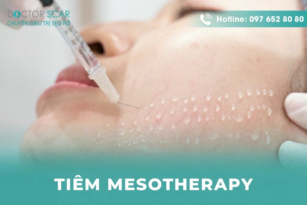 Chăm sóc sau tiêm Meso: cần tránh gì và nên làm gì để kết quả ổn định?