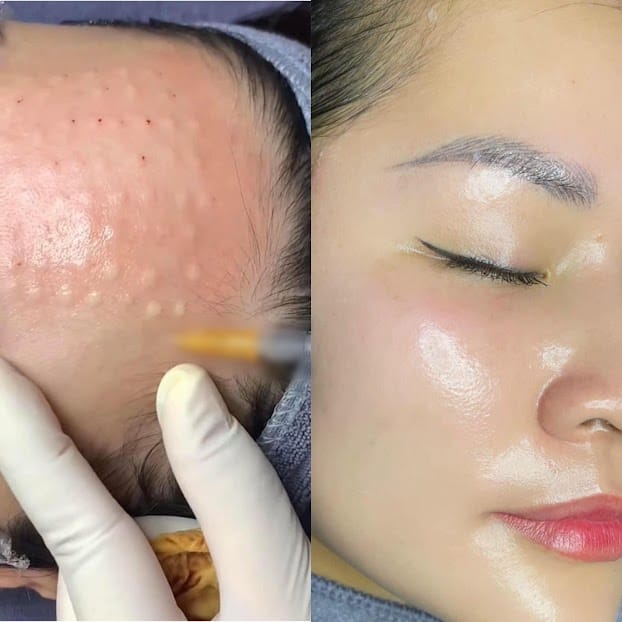 Chi phí và lựa chọn sản phẩm: cần hỏi gì trước khi đồng ý?