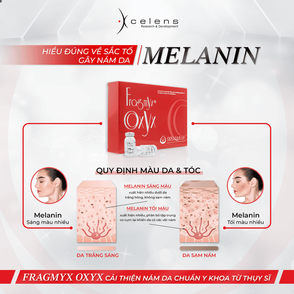 Tiêm Oxyx là gì và liệu đây có phải một sản phẩm được sử dụng trong mesotherapy?