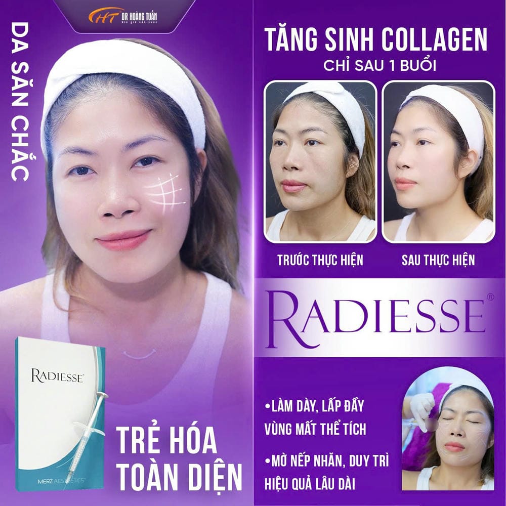 Ai phù hợp hoặc không phù hợp để tiêm Radiesse?