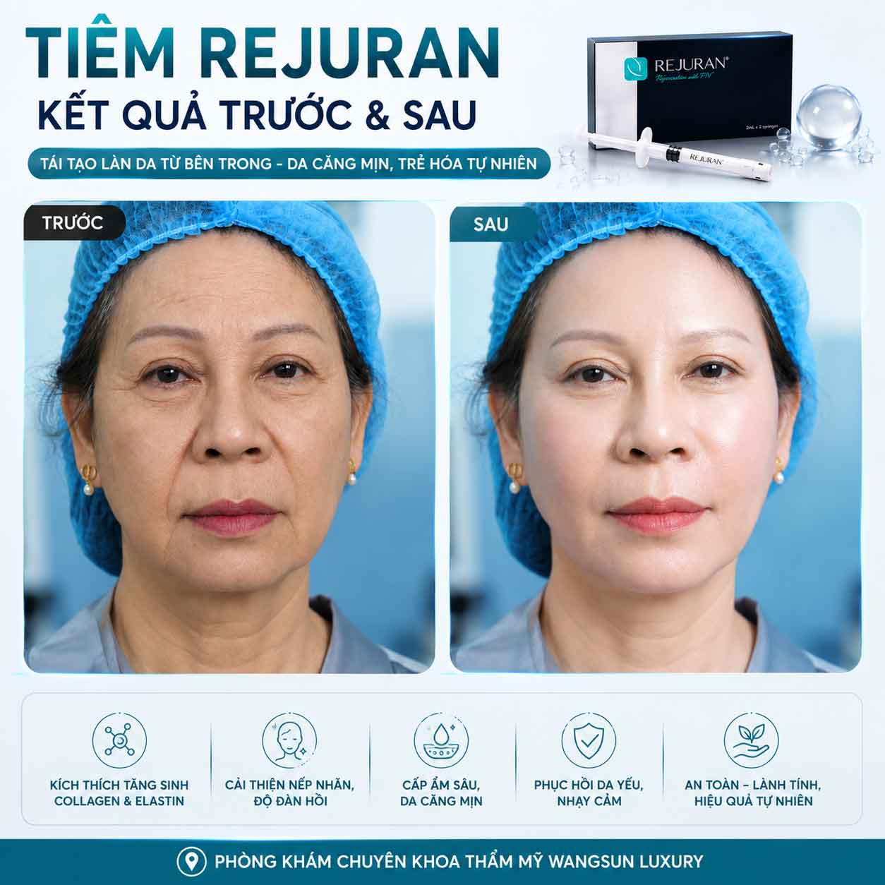 Chi phí tiêm Rejuran gồm những yếu tố nào?