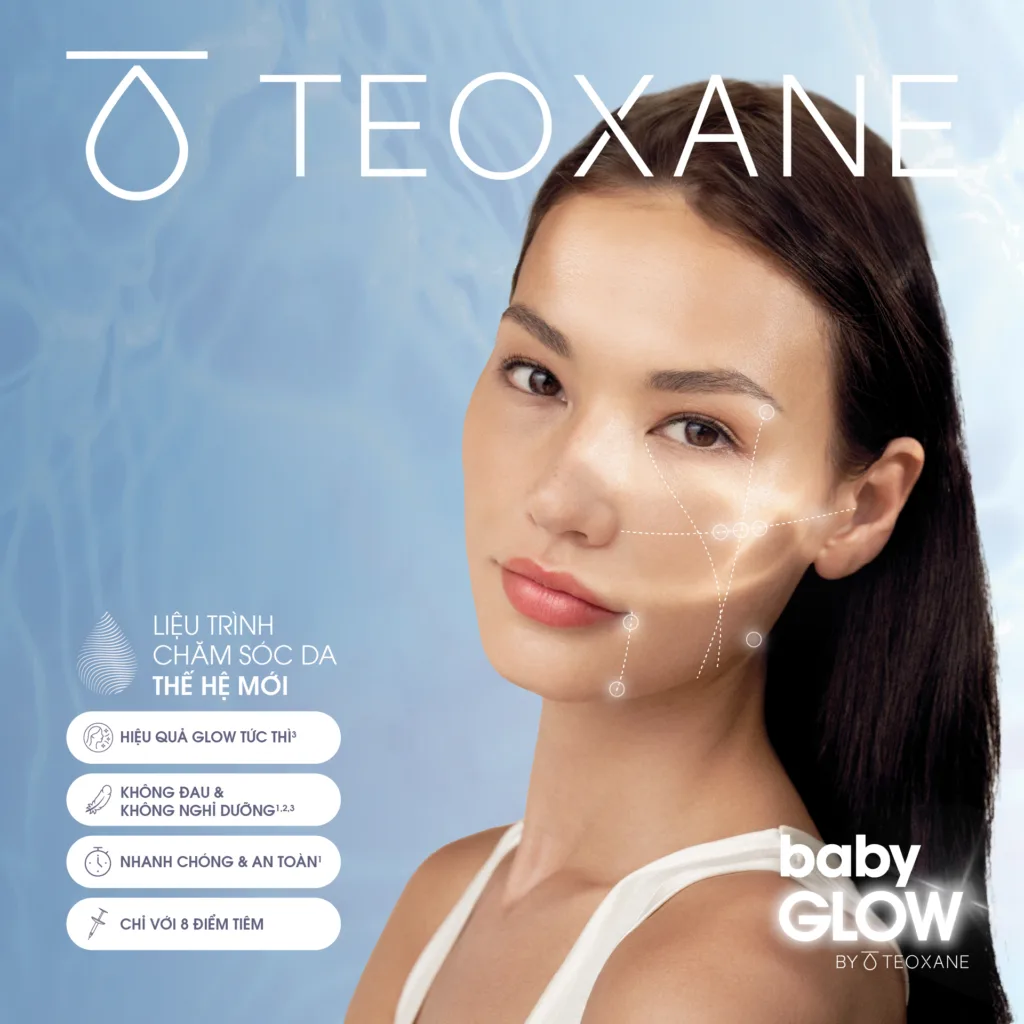 So sánh Teoxane (RHA / Teosyal) với các filler HA phổ biến khác — ưu điểm của filler Teosyal RHA?