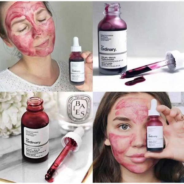 Peel tại nhà và các rủi ro: có nên tự mua pad/gel nồng độ cao?
