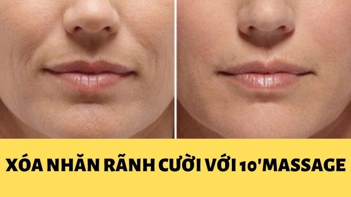 Làm sao để chọn nơi điều trị an toàn và đạt kết quả tự nhiên?
