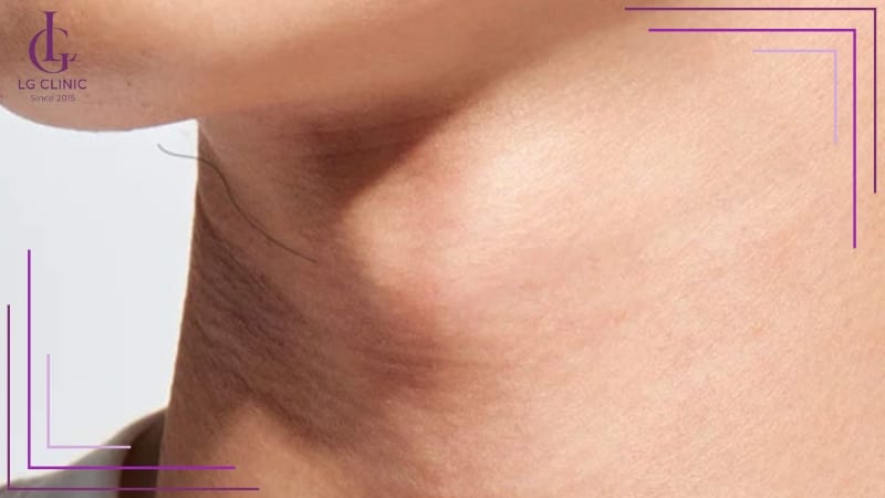 Số buổi và tần suất