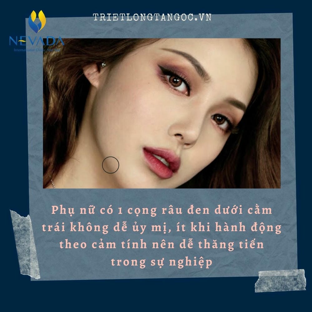 Những câu hỏi thường gặp khách hàng thường băn khoăn