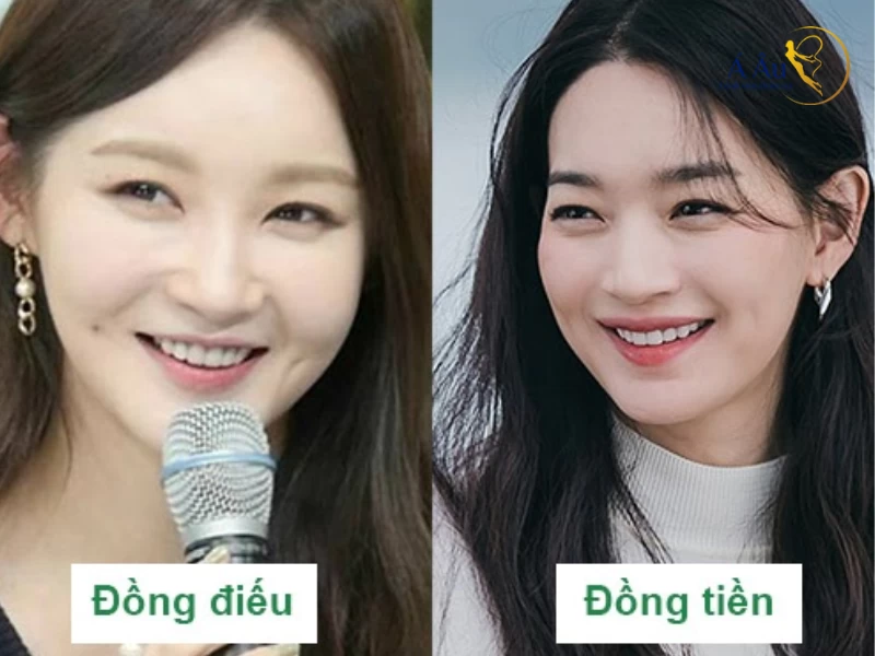 Phẫu thuật chỉnh xương (mentoplasty) có cần thiết không?