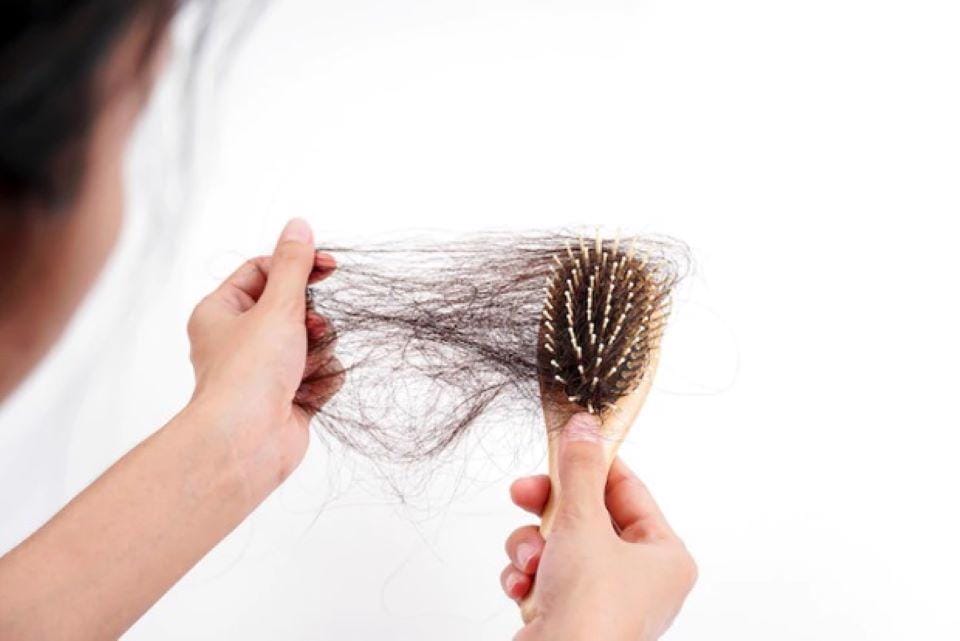So sánh hiệu quả: minoxidil, finasteride, PRP, LLLT, cấy tóc