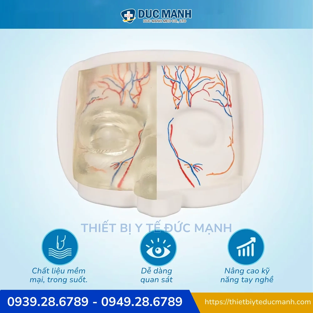 Filler nào đáng tin ở thị trường Việt Nam và tiêu chí chọn sản phẩm?