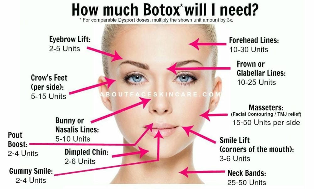 Những rủi ro, tác dụng phụ và biến chứng botox — khi nào cần gọi bác sĩ?