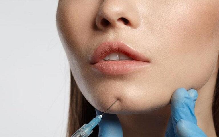 Những câu hỏi thường gặp về tiêm filler