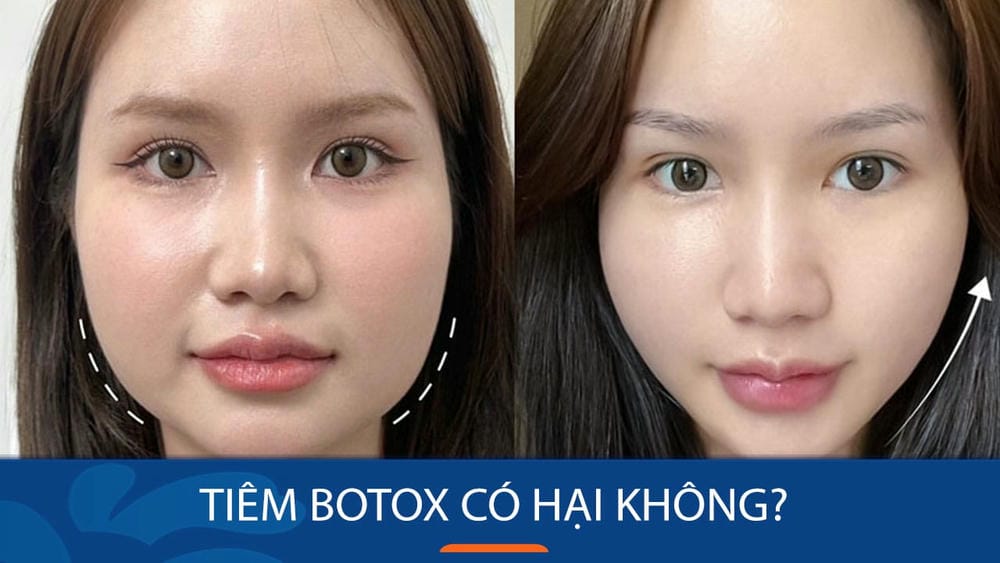 Nếu đã bị biến chứng, có thể làm gì để khắc phục?