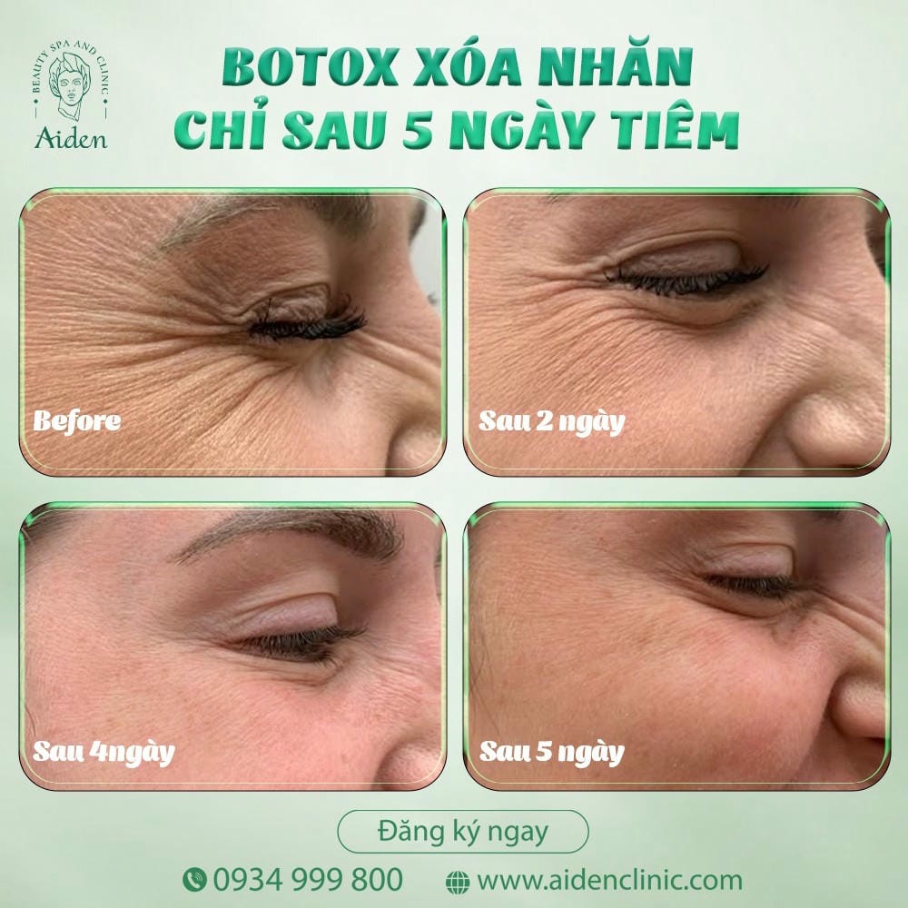 Làm sao để tránh lạm dụng — tần suất, liều và các phương án thay thế an toàn?