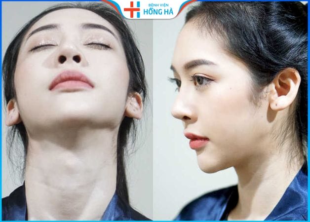 Bạn nên làm bước tiếp theo nào nếu đang phân vân?