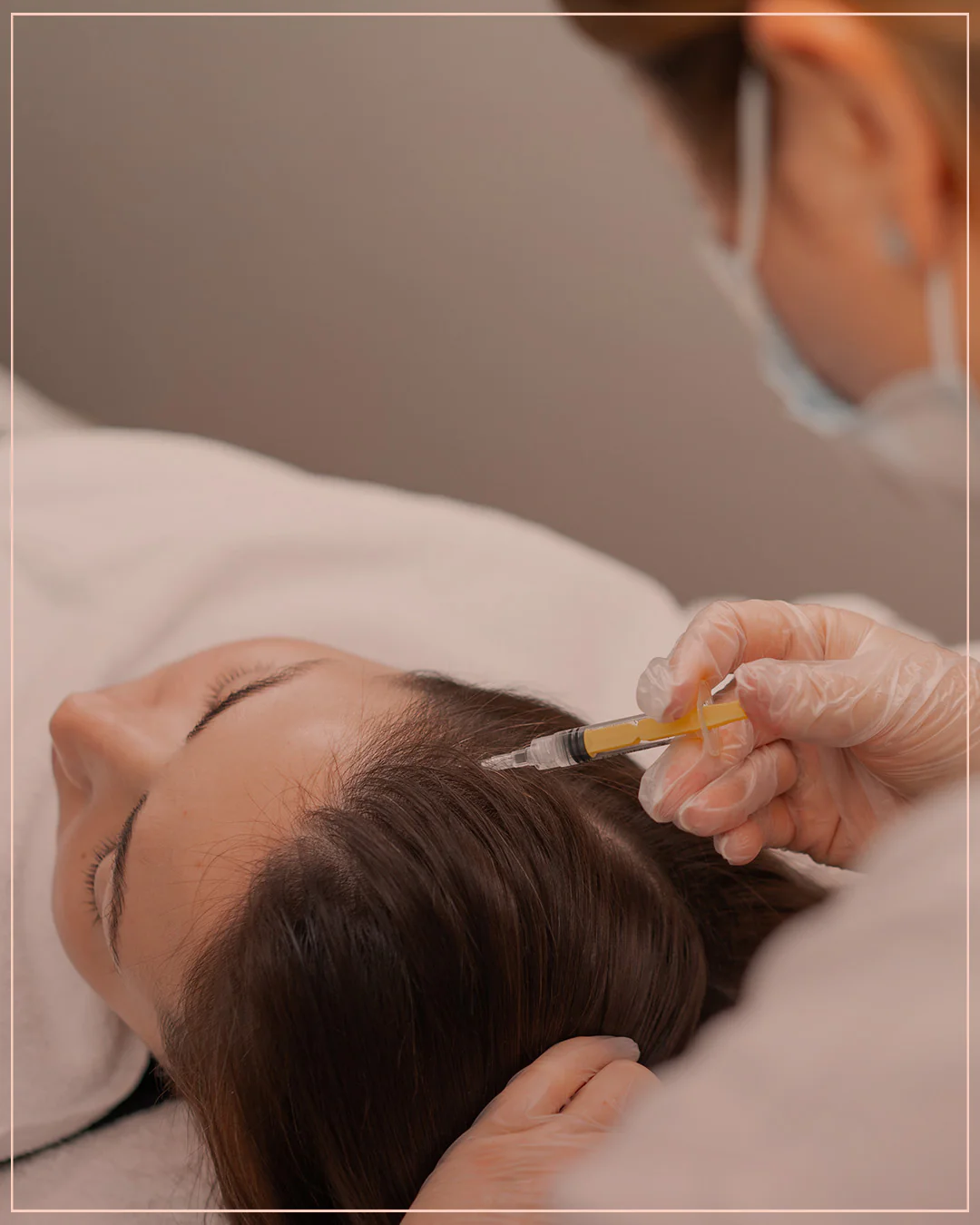 Cơ chế tác động của meso/mesobotox trên da đầu và nang tóc là gì?
