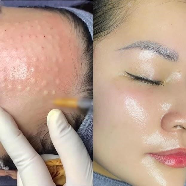 Làm sao chọn nơi thực hiện an toàn và tự nhiên?