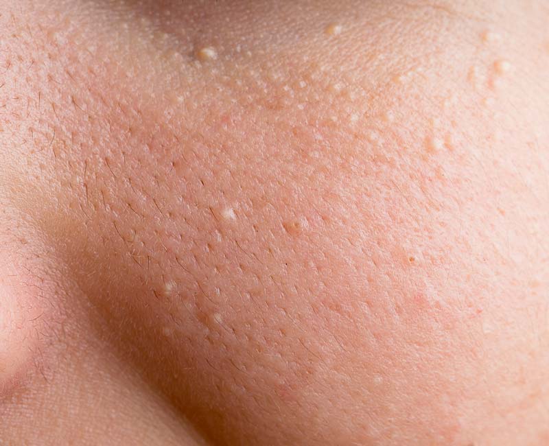 Lựa chọn phương pháp: so sánh ngắn các ưu - nhược