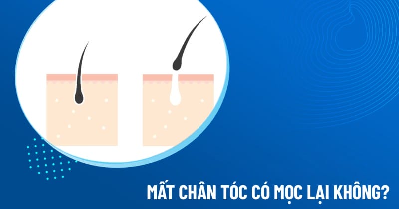 So sánh nhanh các phương pháp: thuốc — thủ thuật — phẫu thuật