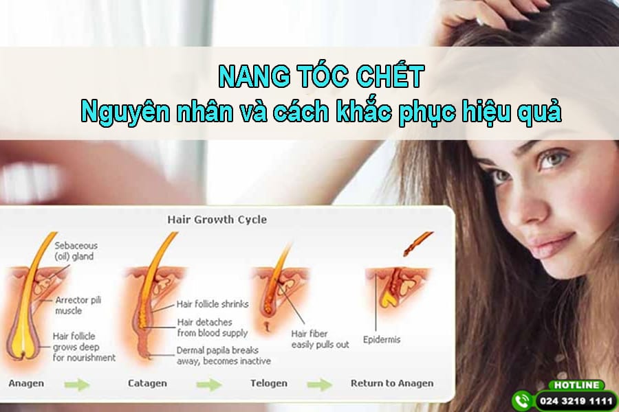 Nang tóc bị chết nghĩa là gì — có phải tóc không thể mọc lại nữa không?