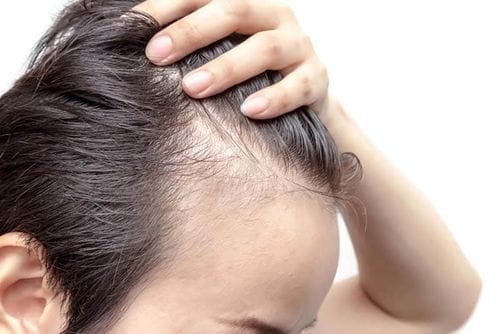 Làm sao biết nang tóc còn sống hay đã chết — dấu hiệu nào cần lưu ý?