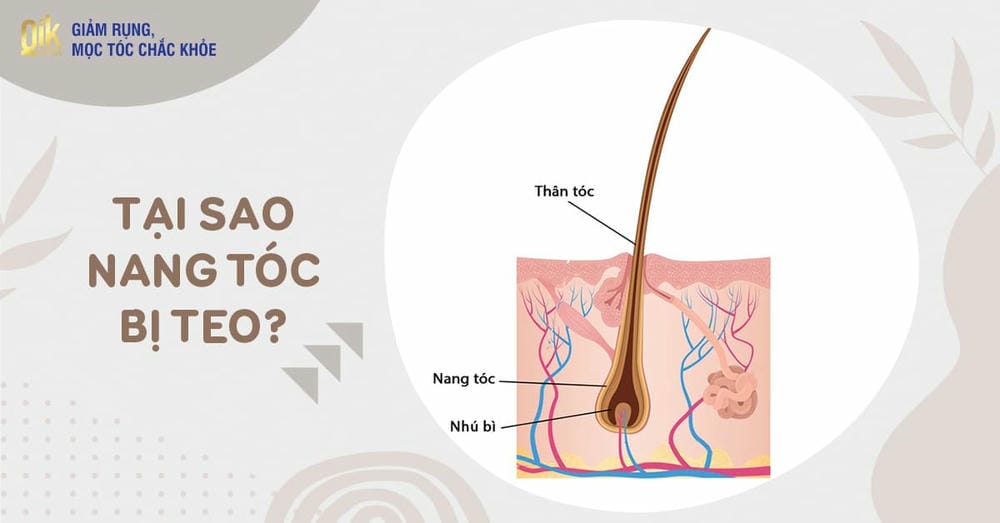 Nếu nang tóc chưa chết hoàn toàn, liệu pháp nào có thể giúp phục hồi?