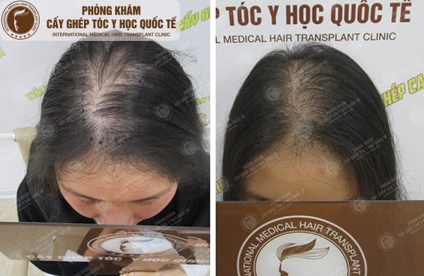 Những câu hỏi bác sĩ thường hỏi và xét nghiệm hay chỉ định thường gặp