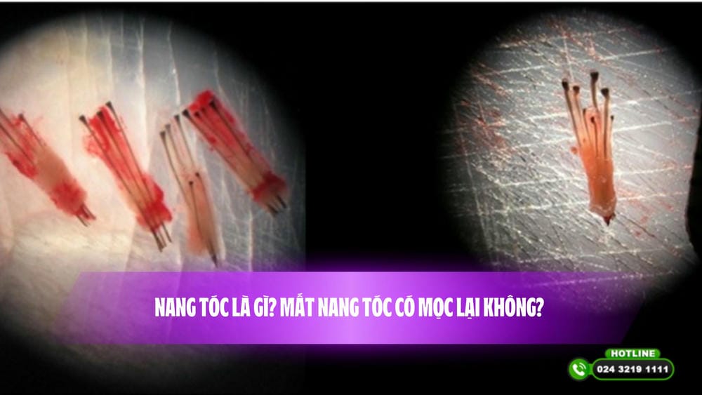 Đầu búp tối (đen hoặc nâu sẫm) — điều đó có sao không?