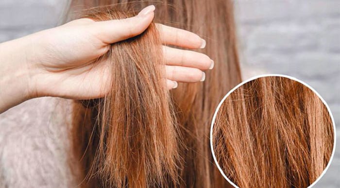 Phương pháp chẩn đoán và so sánh: tự quan sát, trichoscopy hay sinh thiết?