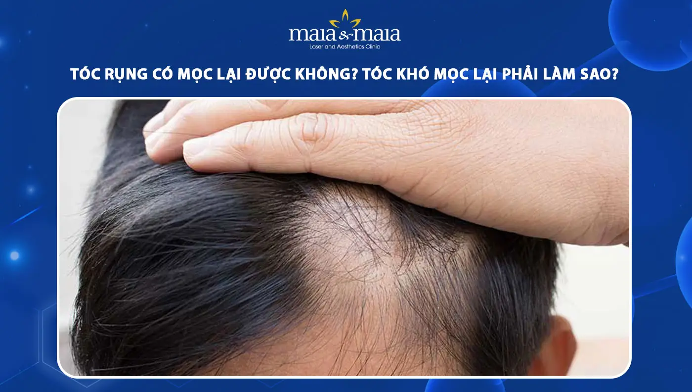 Microneedling, laser và PRP — cơ chế và bằng chứng lâm sàng