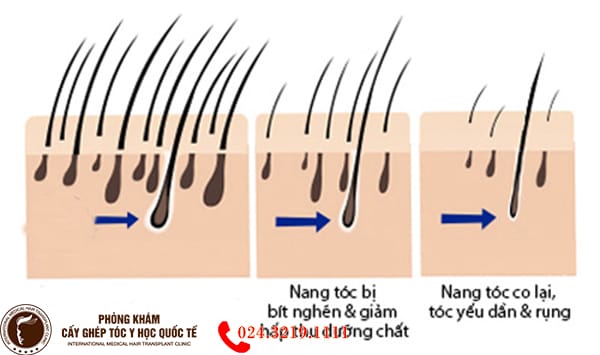 Chăm sóc hàng ngày và thay đổi thói quen giúp nang tóc khỏe hơn — điều gì thực sự có tác dụng?