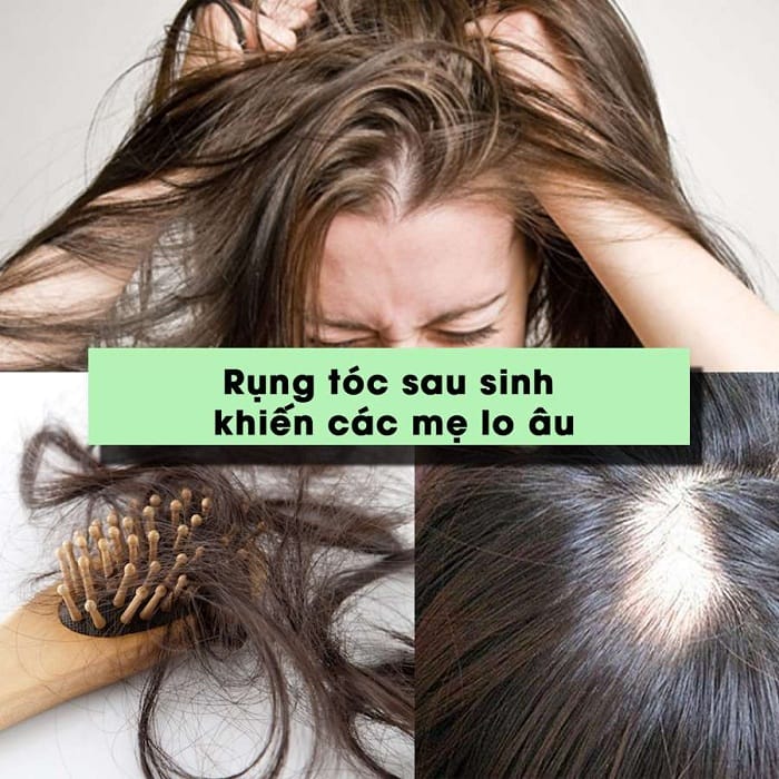 Những liệu pháp an toàn, điều trị nào phù hợp cho mẹ sau sinh?