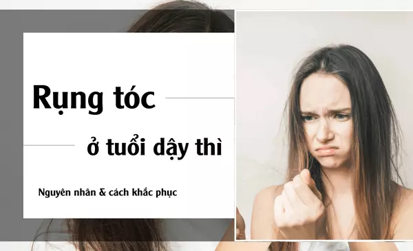 Vì sao ở tuổi dậy thì tóc lại dễ rụng?