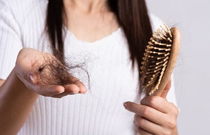 Cấy tóc — khi nào là lựa chọn hợp lý?