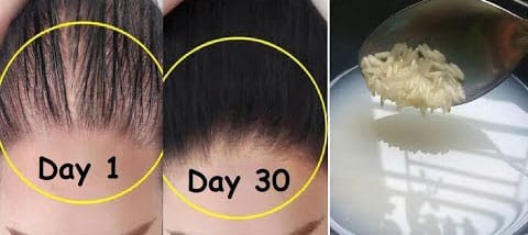 Minoxidil bôi: bằng chứng và cách dùng cơ bản