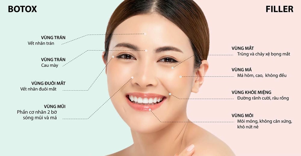 Quy trình tiêm Botox chuẩn tại clinic gồm những bước nào?