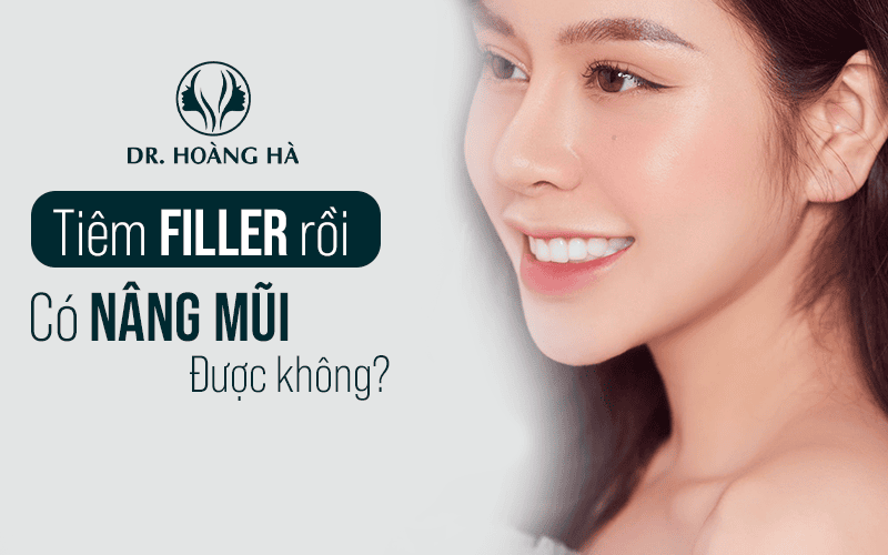 Sau nâng mũi bao lâu có thể tiêm filler an toàn?